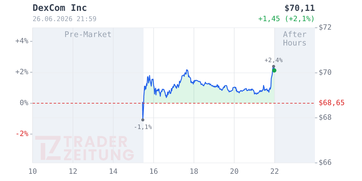 DexCom Chart